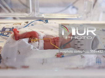 One of the quintuplets, which were born in the University Hospital, is seen in an incubator. Krakow, Poland on February 14, 2023. Three girl...