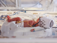 One of the quintuplets, which were born in the University Hospital, is seen in an incubator. Krakow, Poland on February 14, 2023. Three girl...