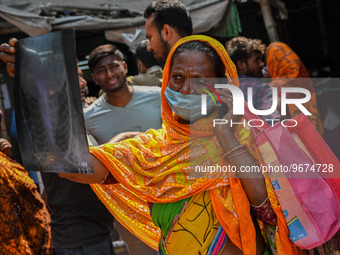 A woman looks at an x-ray of her seven-year-old granddaughter, who is suffering from fever and cough, at a hospital in Kolkata, on March 02,...