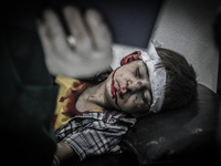 A wounded boy is treated at hospital after Assad forces barrel bomb attack to Arbil district of Damascus, leaving three killed and 35 wounde...